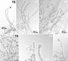 Attēlu rezultāti vaicājumam “Trentepohlia sp.”