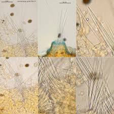 Attēlu rezultāti vaicājumam “Melanospora lagenaria”