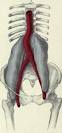 <b>Psoas abscess</b> originating from