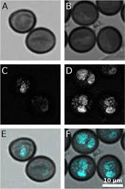 Attēlu rezultāti vaicājumam “Badhamia affinis spores”
