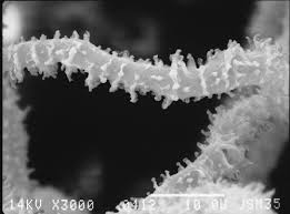 Attēlu rezultāti vaicājumam “Arcyria minuta macro”