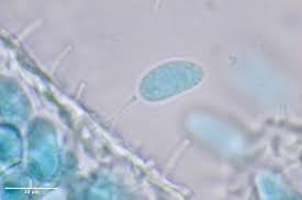 Attēlu rezultāti vaicājumam “Ceratiomyxa morchella spores”