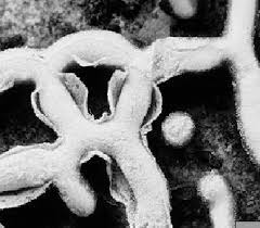 Attēlu rezultāti vaicājumam “Physarum straminipes young”