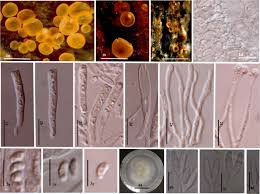 Attēlu rezultāti vaicājumam “Orbilia sp.”