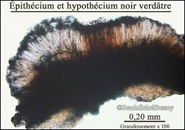 Attēlu rezultāti vaicājumam “Megalaria grossa”