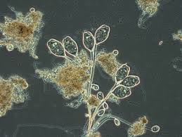 Attēlu rezultāti vaicājumam “Comatricha alta stalked”