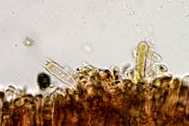 Attēlu rezultāti vaicājumam “Lycogala asperum macro”