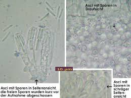 Attēlu rezultāti vaicājumam “Hyalorbilia inflatula”