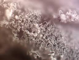 Attēlu rezultāti vaicājumam “Heterotrichia insignis (syn. Arcyria insignis) stalked”