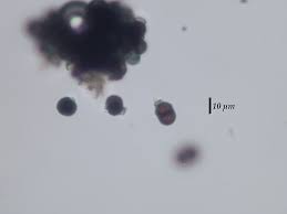 Attēlu rezultāti vaicājumam “Calicium adspersum”