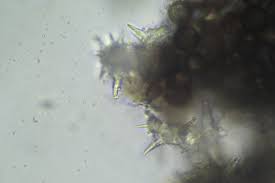 Attēlu rezultāti vaicājumam “Didymium nigripes young”