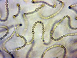 Attēlu rezultāti vaicājumam “Nostoc commune”