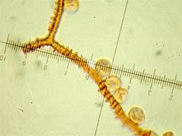 Attēlu rezultāti vaicājumam “Arcyria incarnata spores”