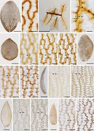 Attēlu rezultāti vaicājumam “Sphagnum austinii sporophyte”