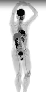 Image result for body scanner