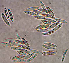 Attēlu rezultāti vaicājumam “Heyderia pusilla”