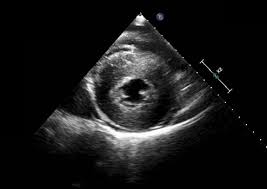 Image result for  ^ L V [ h    