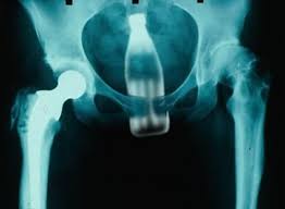 http://t0.gstatic.com/images?q=tbn:ANd9GcTZmUx01aYqf90KaKrth08XHJtls_z8LWFsfNp3g1Oyappz3bGj