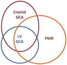 Image result for GCA