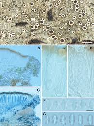 Attēlu rezultāti vaicājumam “Lecanora carpinea”