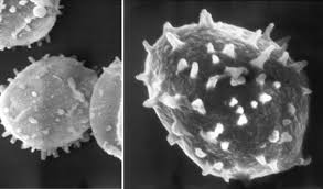 Attēlu rezultāti vaicājumam “Diderma testaceum spores”