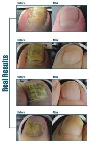 Image result for lunula nail