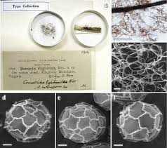 Attēlu rezultāti vaicājumam “Stemonitis flavogenita spores”