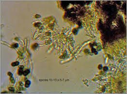 Attēlu rezultāti vaicājumam “Licea pusilla sessile”
