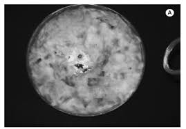 Attēlu rezultāti vaicājumam “Rosellinia desmazieri”