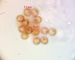 Attēlu rezultāti vaicājumam “Didymium bahiense spores”