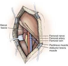 Attēlu rezultāti vaicājumam “Cribraria piriformis young”