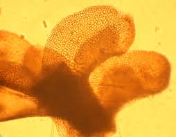 Attēlu rezultāti vaicājumam “Tritomaria exsectiformis cells”