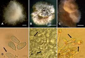 Attēlu rezultāti vaicājumam “Melampsoridium sp.”