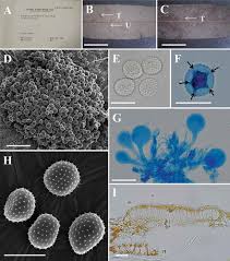 Attēlu rezultāti vaicājumam “Melampsora epitea”