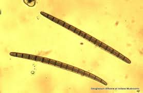 Attēlu rezultāti vaicājumam “Didymium difforme spores”