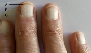 Image result for lunula nail