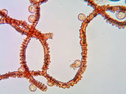 Attēlu rezultāti vaicājumam “Arcyria helvetica”