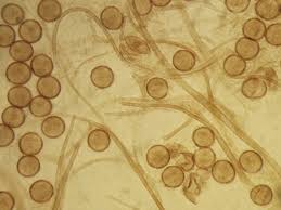 Attēlu rezultāti vaicājumam “Lamproderma violaceum”