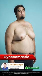 Image result for manboobs