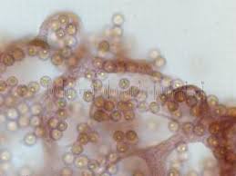 Attēlu rezultāti vaicājumam “Cribrariaceae”