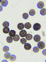 Attēlu rezultāti vaicājumam “Stemonitopsis amoena”