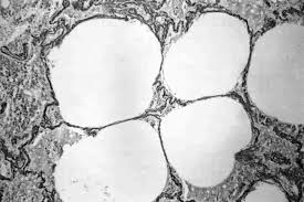 Image result for Leucopleurus acutus