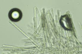 Attēlu rezultāti vaicājumam “Lachnum virgineum”