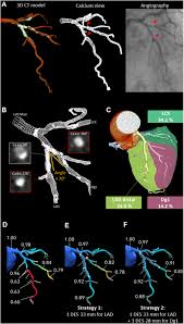 Image result for Hemonetics CCS