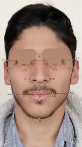 Image result for Co de Crista Chins