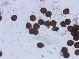Attēlu rezultāti vaicājumam “Diderma subviridifuscum”