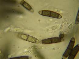 Attēlu rezultāti vaicājumam “Bactridium flavum”