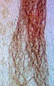 Attēlu rezultāti vaicājumam “Paradiacheopsis rigida stalked”