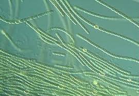 Attēlu rezultāti vaicājumam “Cyanophyta”