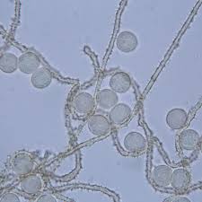 Attēlu rezultāti vaicājumam “Badhamia affinis var. microspora spores”